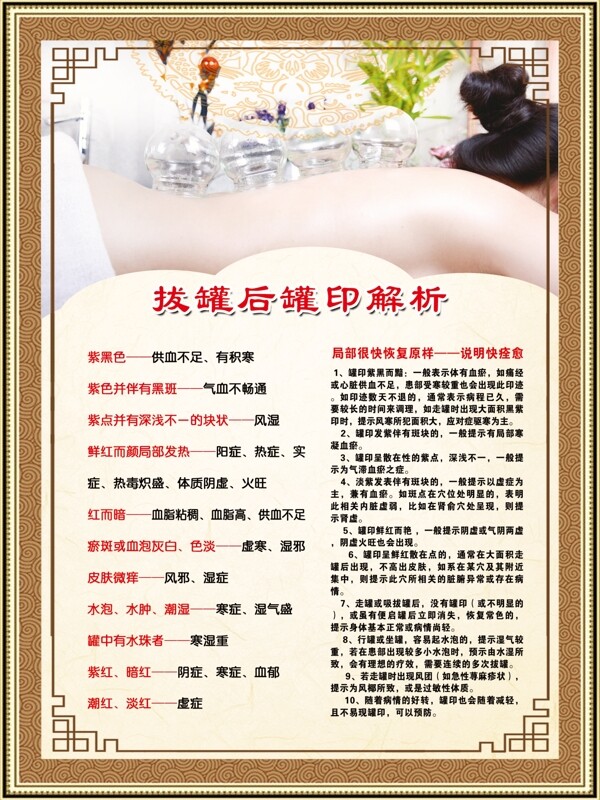 拔罐后罐印解析