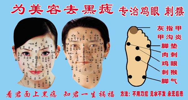 美容去黑痣圖片