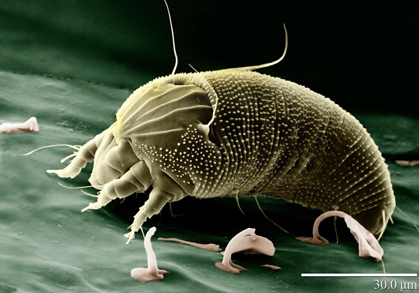 微型螨虫图片