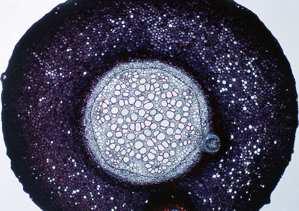 圆形斑点细胞结晶