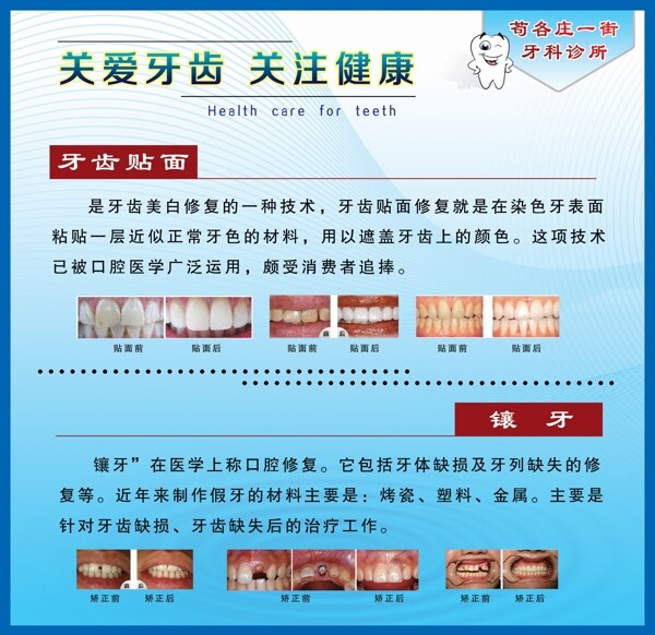牙齿宣传海报图片