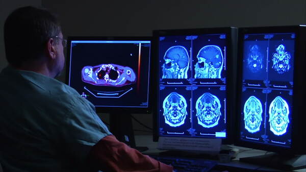 放射科医生看监控录像脑扫描的股票视频免费下载