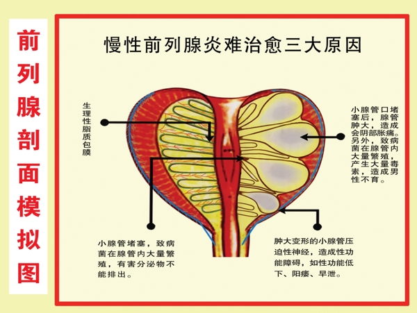 前列腺剖面模拟图图片